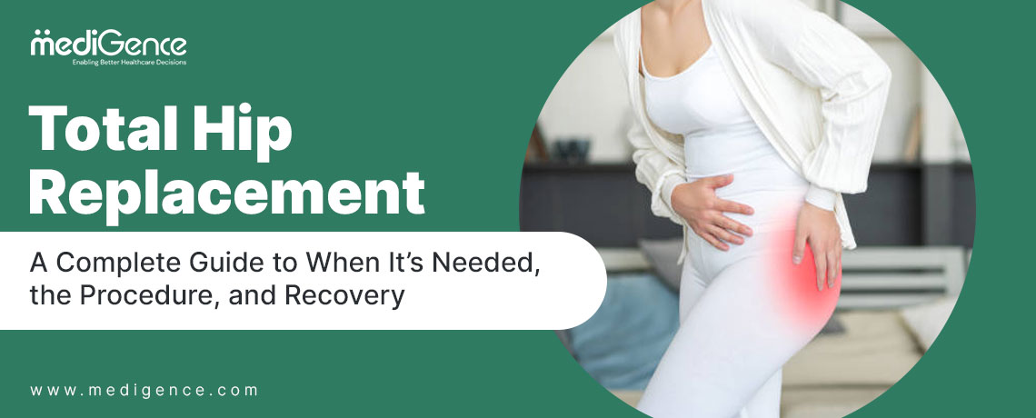 Обща подмяна на тазобедрената става: Пълно ръководство за това, когато е необходимо, процедурата и възстановяването
